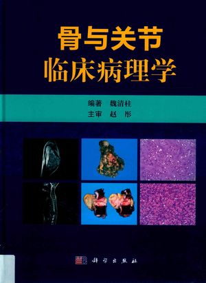 骨与关节临床病理学_魏清柱编著2019.03_335_PDF带书签目录_14624422